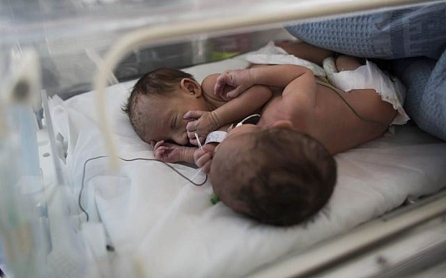 These conjoined twins of a Palestinian woman were returned to the home near Hebron on June 2, 2013 with their mother and grandmother after Israeli doctors determined that they were unable to separate and save the babies' lives. (photo credit: Yonatan Sindel/Flash90). These conjoined twins of a Palestinian woman were returned to the home near Hebron on June 2, 2013 with their mother and grandmother after Israeli doctors determined that they were unable to separate and save the babies' lives. (photo credit: Yonatan Sindel/Flash90).