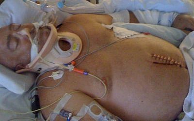 David Blackburn, in a coma after a near-fatal car accident (photo credit: Courtesy)