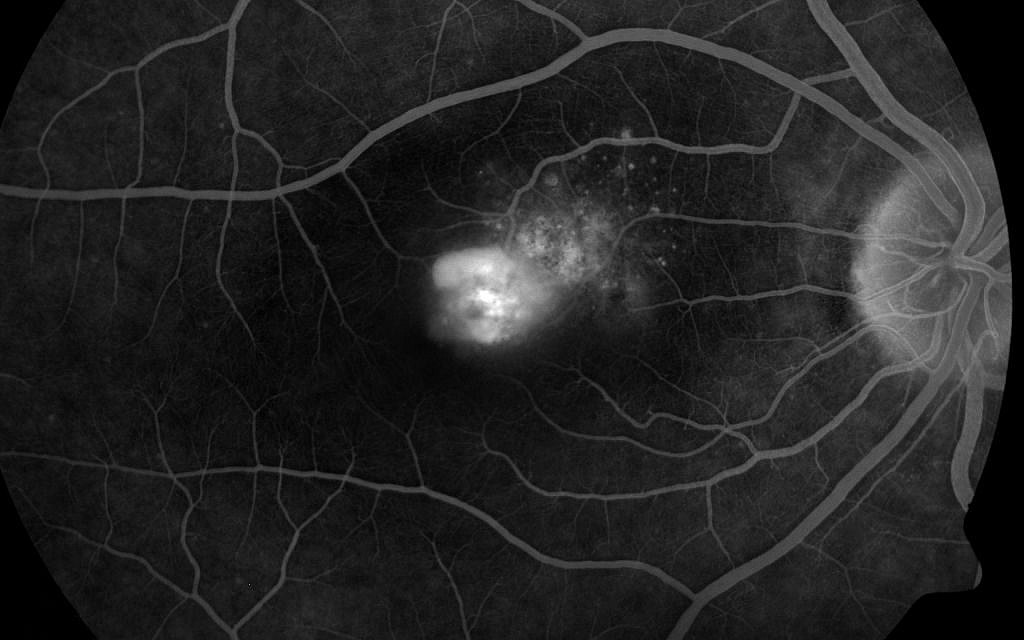 Tamar Dovrat says that her photo "Optic Nerve" is "a moment before it has been destroyed by reason." (Courtesy Tamar Dovrat)