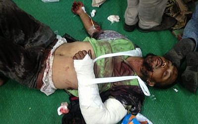 A Muslim Brotherhood activist said to have been injured in clashes Monday, July 8, 2013 (photo credit: Gehad El-Haddad/Muslim Brotherhood, via Twitter)