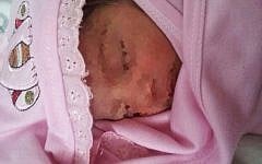 Baby Usa'ma, found near the Damascus gate in Jerusalem last week (photo Credit: Flash90)