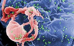 Scanning electron micrograph of HIV-1 budding (in green) from cultured lymphocyte. (photo credit: CDC/public domain)