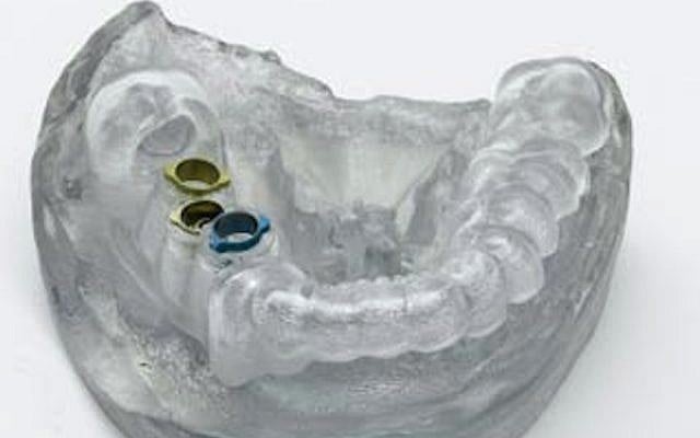 Implant surgical guide produced on a Stratasys Objet Eden260V 3D Printer using Stratasys’ Clear Bio-compatible 3D printing material (photo credit: Courtesy) Implant surgical guide produced on a Stratasys Objet Eden260V 3D Printer using Stratasys’ Clear Bio-compatible 3D printing material (photo credit: Courtesy)