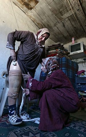 Reem Diab, 34, who lost her leg on October 25, 2012  takes off her artificial leg with the help of her relative, right. March 27, 2014 (photo credit: AP Photo/Bilal Hussein)
