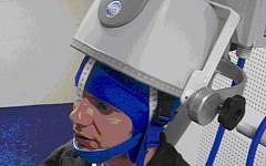 A Brainsway device in action. (photo credit: courtesy)