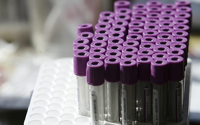 Illustration of test tubes for blood tests. (photo credit: Kobi Gideon / FLASH90) Illustration of test tubes for blood tests. (photo credit: Kobi Gideon / FLASH90)