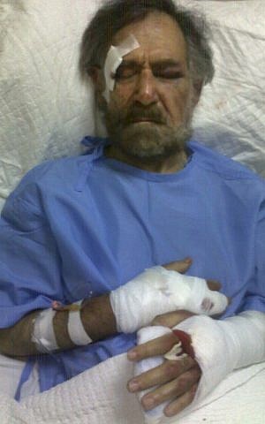 In this August 25, 2011, file photo, released by the Syrian News Station website, Syrian cartoonist Ali Farzat lies injured at a hospital in Damascus, Syria. (photo credit: AP/Syrian News Station, HO, File) 