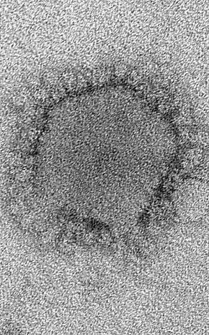 A highly-magnified negatively-stained transmission electron micrograph image of the Middle East Respiratory Syndrome Coronavirus (MERS-CoV). (photo credit: Centers for Disease Control/ Cynthia Goldsmith; Azaibi Tamin, Ph.D.)
