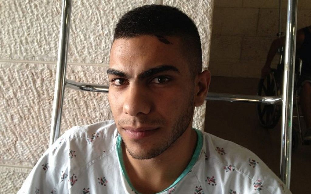 Beit Hanina resident Samer Mahfouz at Hadassah Ein Kerem hospital, July 28, 2014 (photo credit: Elhanan Miller/Times of Israel) Beit Hanina resident Samer Mahfouz at Hadassah Ein Kerem hospital, July 28, 2014 (photo credit: Elhanan Miller/Times of Israel)