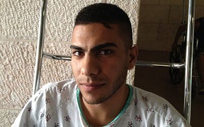 Beit Hanina resident Samer Mahfouz at Hadassah Ein Kerem hospital, July 28, 2014  (photo credit: Elhanan Miller/Times of Israel)