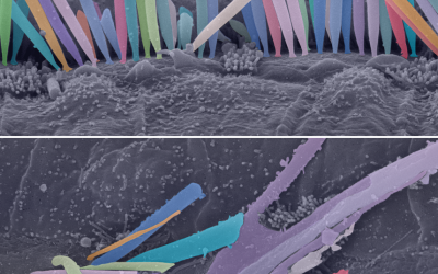 Scanning electron microscopy of inner hair cells from cochleas of mice without (top) and with (bottom) the mutation. (photo credit: Courtesy)
