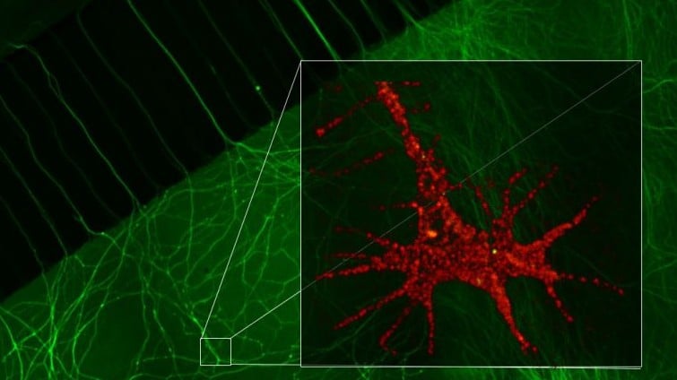 A microscope image of a sensory neuron, with an inset of the rabies virus (green) binding to the p75 receptor (red). (photo credit: Courtesy) A microscope image of a sensory neuron, with an inset of the rabies virus (green) binding to the p75 receptor (red). (photo credit: Courtesy)