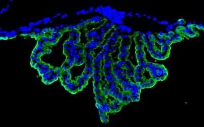 Final hi-res for Science Immunofluorescence microscopy image of the brain’s choroid plexus. (photo credit: Kuti Baruch and Aleksandra Deczkowska)