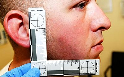 This undated photo released by the St. Louis County Prosecuting Attorney's office on Monday, Nov. 24, 2014, shows Ferguson police officer Darren Wilson during his medical examination after he fatally shot Michael Brown, in Ferguson, Missouri. (photo credit: AP Photo/St. Louis County Prosecuting Attorney's Office) 