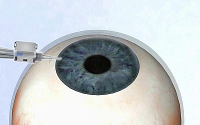 EyeYon's contact lenses (Photo credit: Courtesy)