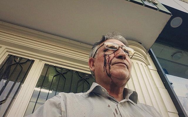 Illustrative: Mohammad Nourizad appears with a bloody face after protesting outside the home of Iran's Supreme Leader Ali Khaminei, October 14, 2014 (photo credit: courtesy/Abazar Noorizad) Illustrative: Mohammad Nourizad appears with a bloody face after protesting outside the home of Iran's Supreme Leader Ali Khaminei, October 14, 2014 (photo credit: courtesy/Abazar Noorizad)