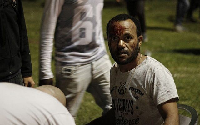 An Ethiopian Israeli man receives medical treatment after being injured at an anti-police brutality demonstration in Tel Aviv's Rabin Square on Sunday, May 3, 2015. (photo credit: Judah Ari Gross/Times of Israel staff) An Ethiopian Israeli man receives medical treatment after being injured at an anti-police brutality demonstration in Tel Aviv's Rabin Square on Sunday, May 3, 2015. (photo credit: Judah Ari Gross/Times of Israel staff)