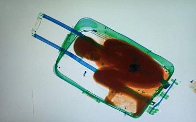An x-ray shows a little boy in a suitcase, smuggled in from Africa to Spain, May 8, 2015. (Photo credit: AFP)
