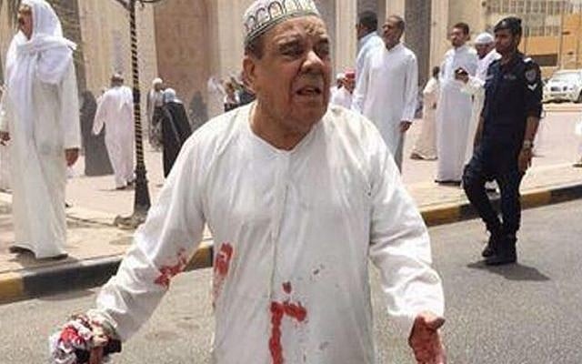 A man in a blood-soaked dishdasha following of a deadly blast at a Shiite mosque in Kuwait City, Friday, June 26, 2015. (Kuwaitna News via AP)