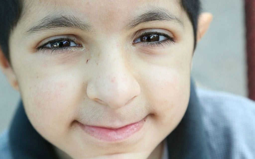 Eitan, age 7, has two brothers, Ayalon and Elad. He was born with a rare genetic syndrome affecting his motor and speech capabilities (Photo credit: Rick Guidotti)