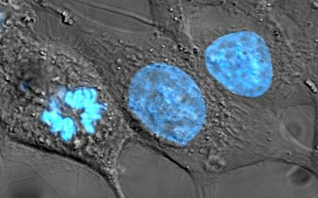 Human cancer cells with nuclei (specifically the DNA) stained blue. The central and rightmost cell are in interphase, so the entire nuclei are labeled. The cell on the left is going through mitosis and its DNA has condensed.  (TenOfAllTrades/Wikipedia)