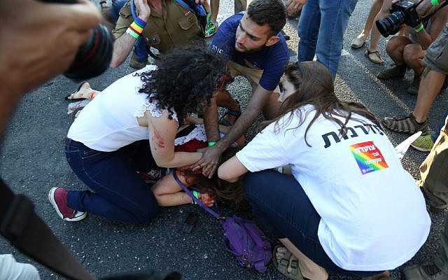 An injured woman after a stabbing in Jerusalem on July 30, 2015. (Eric Cortellessa/Times of Israel) An injured woman after a stabbing in Jerusalem on July 30, 2015. (Eric Cortellessa/Times of Israel)