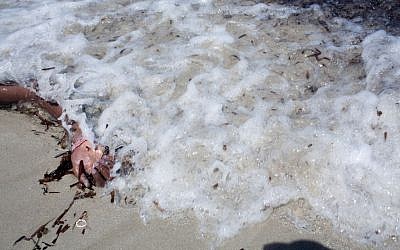 The arm of a dead migrant is seen at the waterfront of Zuwara, about 105 kilometers (65 miles) west of Tripoli, Libya, Friday, Aug. 28, 2015. (AP Photo/Mohamed Ben Khalifa)