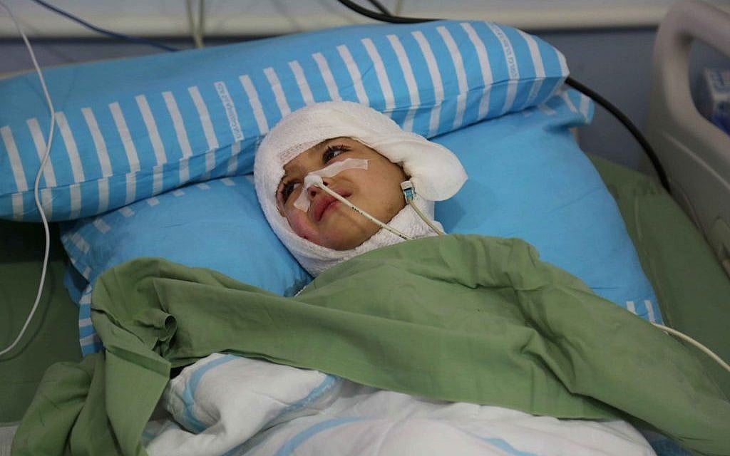 Five-year-old Ahmed Dawabsha lies in his hospital bed at the Chaim Sheba Medical Center at Tel Hashomer, August 24, 2015. (Eric Cortellessa/Times of Israel) Five-year-old Ahmed Dawabsha lies in his hospital bed at the Chaim Sheba Medical Center at Tel Hashomer, August 24, 2015. (Eric Cortellessa/Times of Israel)