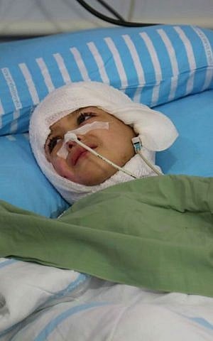 Five-year-old Ahmed Dawabsha lies in his hospital bed at The Chaim Sheba Medical Center at Tel Hashomer, August 24, 2015 (Eric Cortellessa/Times of Israel)