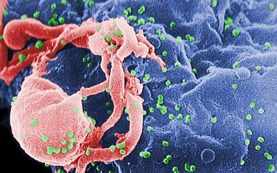 Scanning electron micrograph of HIV-1 budding (in green) from cultured lymphocyte. This image has been colored to highlight important features (Wikimedia Commons, public domain/Centers for Disease Control and Prevention's Public Health Image Library)