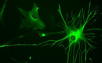 Illustrative: Glial cells known as astrocytes in a 23-week fetal brain culture. (Bruno Pascal/Wikipedia/CC BY-SA 3.0)