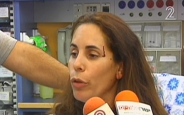 Rivi Ohayon speaking to the media from a hospital bed after being attacked on a road near Jerusalem by Palestinian stone throwers on October 7, 2015. (Screen capture: Channel 2) Rivi Ohayon speaking to the media from a hospital bed after being attacked on a road near Jerusalem by Palestinian stone throwers on October 7, 2015. (Screen capture: Channel 2)