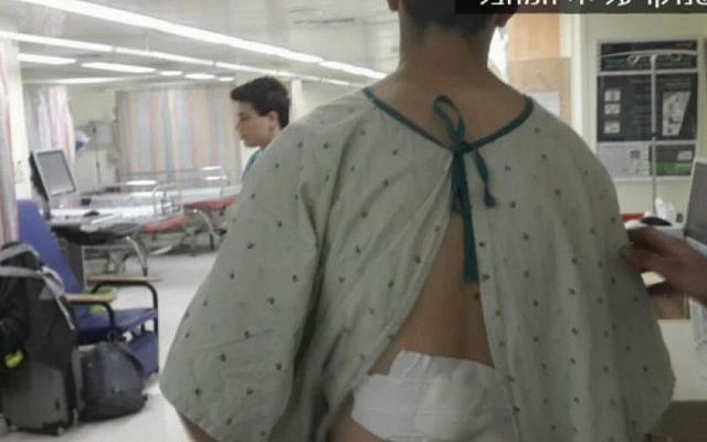 The 17-year-old victim of a stabbing attack outside Jerusalem's Old City on January 30, 2016. (Screen capture: Ynet) The 17-year-old victim of a stabbing attack outside Jerusalem's Old City on January 30, 2016. (Screen capture: Ynet)