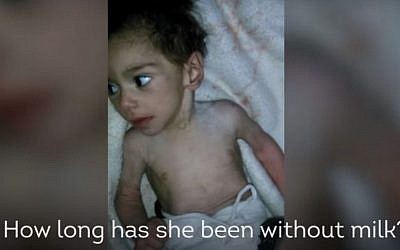 An image of a starving child in Madaya, Syria, a city that has been under siege by pro-government forces for six months. (screen capture: YouTube) 