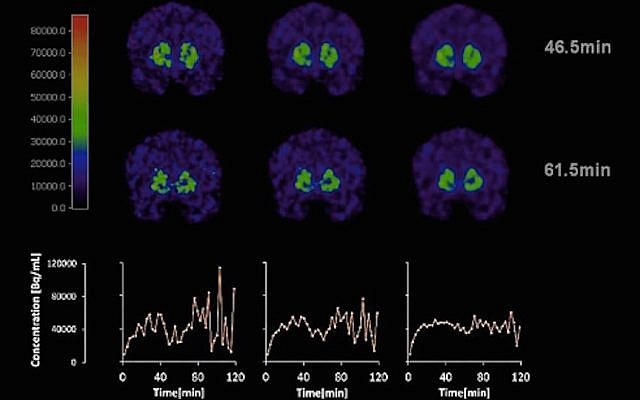 A 'dopamine movie' (screenshot) A 'dopamine movie' (screenshot)