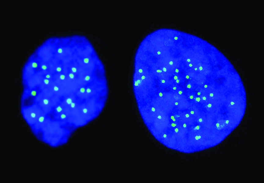 A haploid cell with 23 chromosomes (left), and a diploid cell with 46 chromosomes (right). (Credit: Columbia University Medical Center/Hebrew University.) A haploid cell with 23 chromosomes (left), and a diploid cell with 46 chromosomes (right). (Credit: Columbia University Medical Center/Hebrew University.)