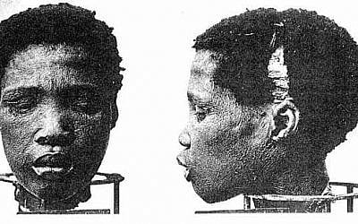 Head of Herero prisoner used for medical experimentation by German colonialists. (Wikipedia)