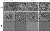 In this image, the untreated control surface shows  dense bacteria colonization (above), while the bottom area shows how the Cu-MCF coating prevents formation of biofilm. (Courtesy)
