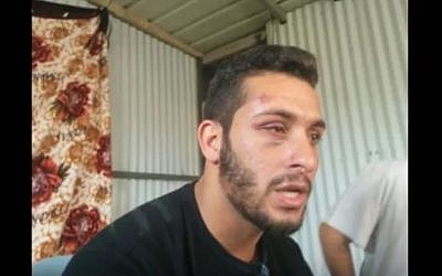 A photo of Maysam Abu Alqian taken after plainclothes police officers beat him during an arrest in Tel Aviv on May 22, 2016. (screen capture: YouTube)