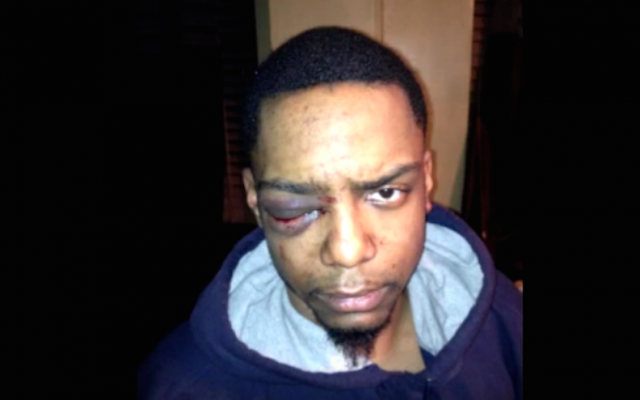 Taj Patterson was allegedly beaten by a group of Hasidic Jews, in Williamsburg, Brooklyn in 2013. (YouTube screen capture) Taj Patterson was allegedly beaten by a group of Hasidic Jews, in Williamsburg, Brooklyn in 2013. (YouTube screen capture)