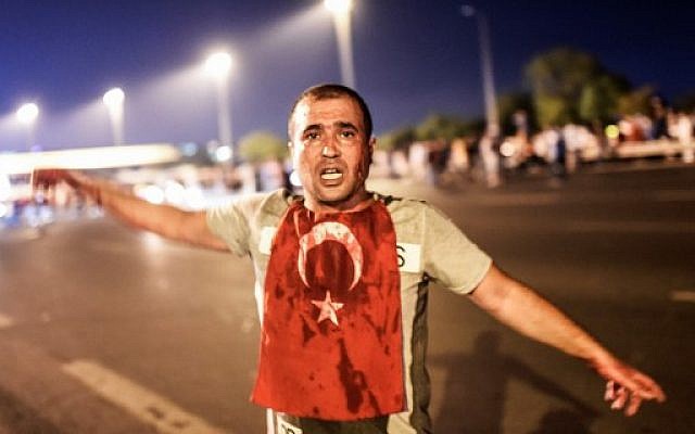 A man covered with blood stands near the Bosphorus bridge as Turkish military clash with people at the entrance to the bridge in Istanbul on July 16, 2016.
Turkish military forces on July 16 opened fire on crowds gathered in Istanbul following a coup attempt, causing casualties, an AFP photographer said. The soldiers opened fire on grounds around the first bridge across the Bosphorus dividing Europe and Asia, said the photographer, who saw wounded people being taken to ambulances. (AFP PHOTO / Bulent KILIC) A man covered with blood stands near the Bosphorus bridge as Turkish military clash with people at the entrance to the bridge in Istanbul on July 16, 2016.
Turkish military forces on July 16 opened fire on crowds gathered in Istanbul following a coup attempt, causing casualties, an AFP photographer said. The soldiers opened fire on grounds around the first bridge across the Bosphorus dividing Europe and Asia, said the photographer, who saw wounded people being taken to ambulances. (AFP PHOTO / Bulent KILIC)