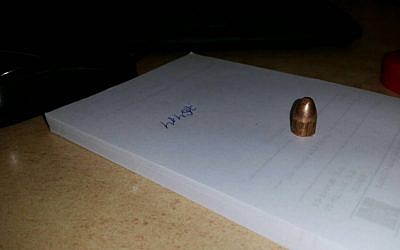 A slug extracted from the skull of a Jerusalem woman on Monday, July 11, 2016 (Hadar Elboim/Hadassah Hospital)