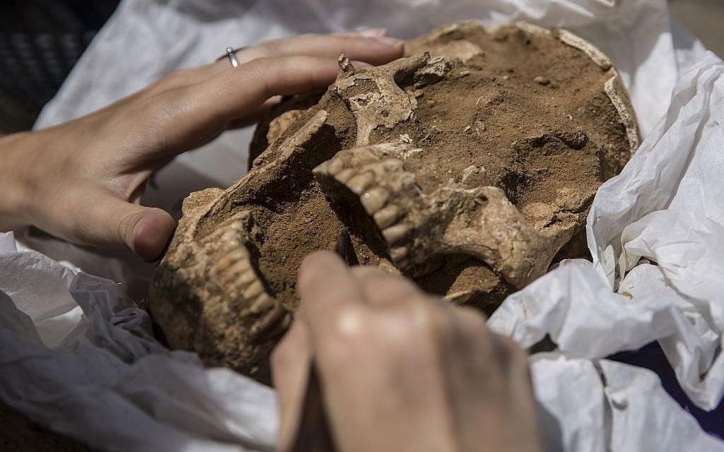 A skull from a 10th-9th century BC burial in the excavation of the Philistine cemetery by the Leon Levy Expedition to Ashkelon. (Tsafrir Abayov/Leon Levy Expedition)
