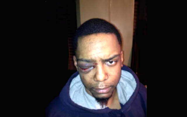 Taj Patterson was allegedly beaten by a group of Hasidic Jews in Brooklyn in 2013. (Screenshot from YouTube via JTA) Taj Patterson was allegedly beaten by a group of Hasidic Jews in Brooklyn in 2013. (Screenshot from YouTube via JTA)