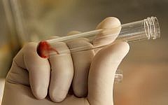 Illustrative photo of blood in a test tube. (Margalit Slovin/Flash90)