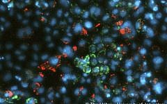 Live fluorescent imaging of hepatitis C viruses (red) seemingly avoiding liver cells that accumulate fat (green) in spite of the virus's well known contribution to fatty liver disease (Courtesy of Prof. Yaakov Nahmias)