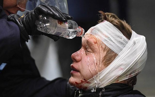 Police officers treat an injured protester from the neo-Nazi Nordic Resistance Movement (Nordiska motstandsrorelsens) in central Stockholm on November 12, 2016 after a protest against migrants. (AFP PHOTO / JONATHAN NACKSTRAND)
