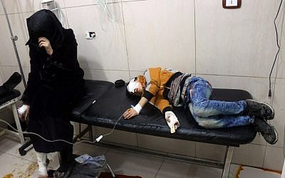 Wounded Syrians are seen on a table in a crowded makeshift hospital in eastern Aleppo as regime aircraft and artillery pounded neighborhoods in the rebel-held sector of Syria's second city on November 18, 2016. (AFP PHOTO/THAER MOHAMMED)