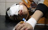 A wounded Syrian boy lies on a table in a crowded makeshift hospital in eastern Aleppo as regime aircraft and artillery pounded neighbourhoods in the rebel-held sector of Syria's second city on November 18, 2016. (AFP PHOTO / THAER MOHAMMED)