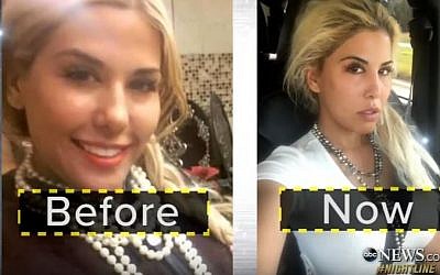Tiffany Taylor before and after shots after having surgery to look like Ivanka Trump. (Screen capture: YouTube)